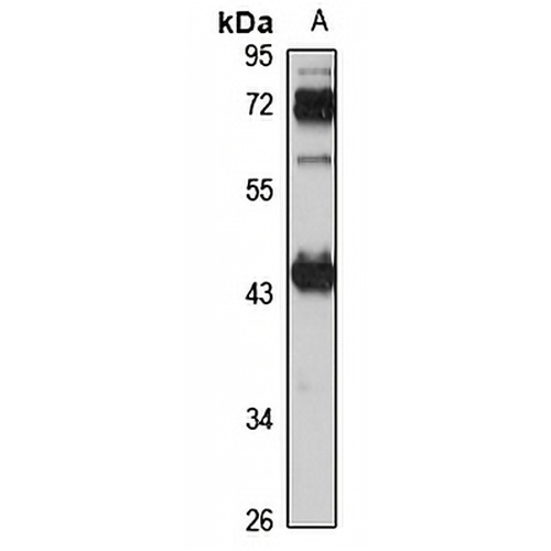 CHAD Rabbit Polyclonal Antibody