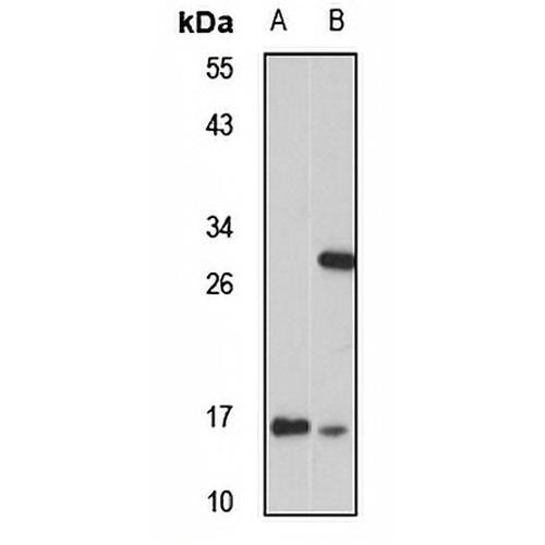 CHCHD2 Rabbit Polyclonal Antibody