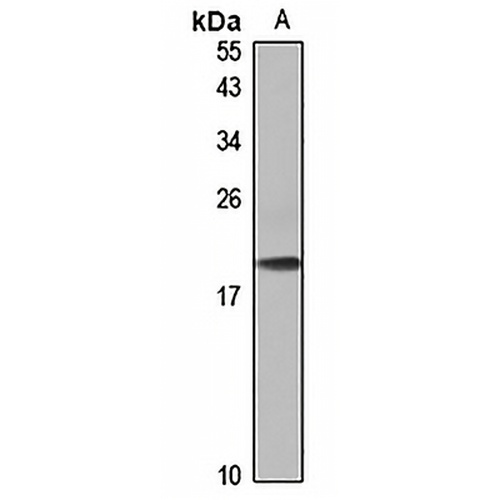 CHIC2 Rabbit Polyclonal Antibody