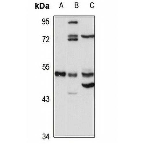 Choline Kinase alpha Rabbit Polyclonal Antibody