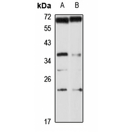 CHMP3 Rabbit Polyclonal Antibody