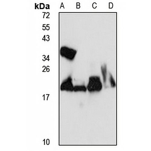 CHP1 Rabbit Polyclonal Antibody