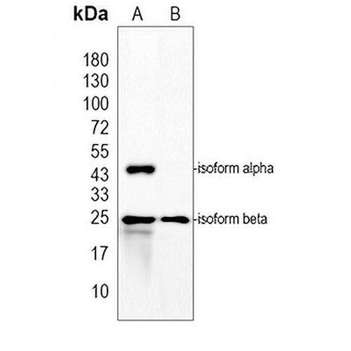 CHPT1 Rabbit Polyclonal Antibody