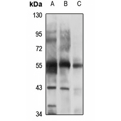 CHRNB3 Rabbit Polyclonal Antibody