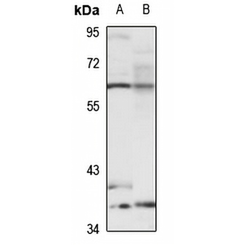 AChR delta Rabbit Polyclonal Antibody