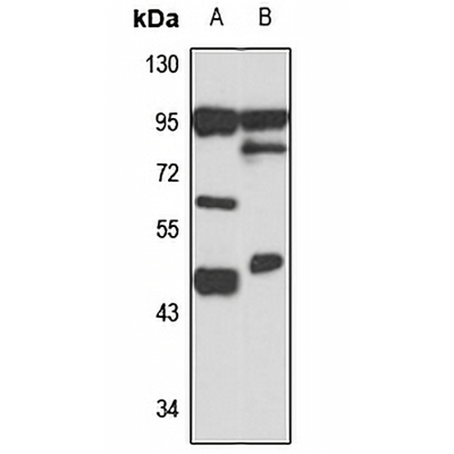 CHST11 Rabbit Polyclonal Antibody