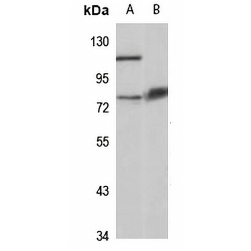 CHST15 Rabbit Polyclonal Antibody