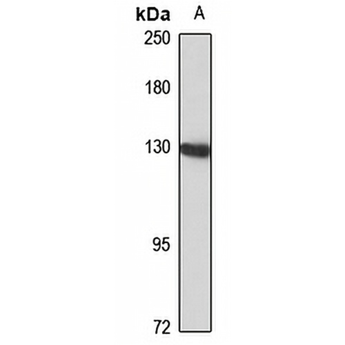 CTF18 Rabbit Polyclonal Antibody