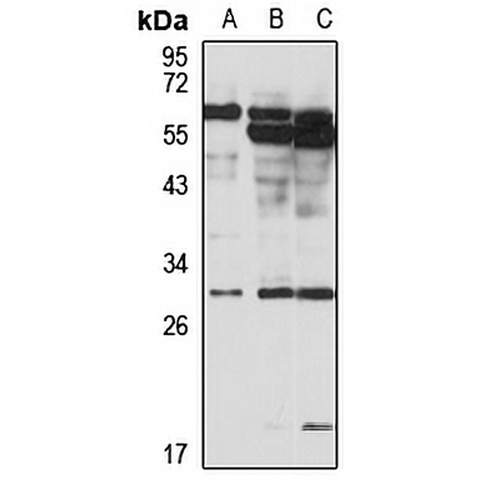 CITED2 Rabbit Polyclonal Antibody