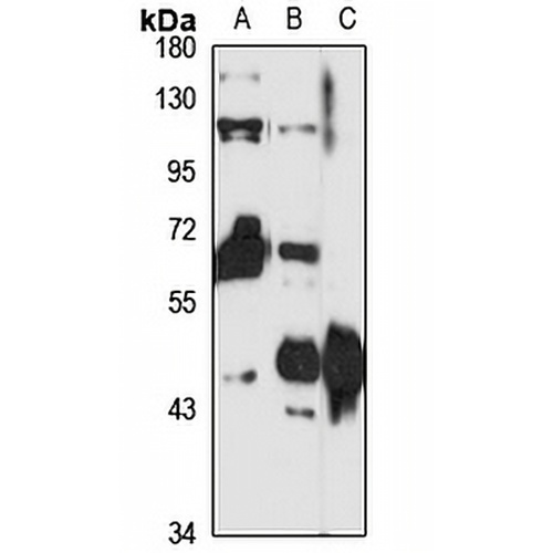 Creatine Kinase B Rabbit Polyclonal Antibody