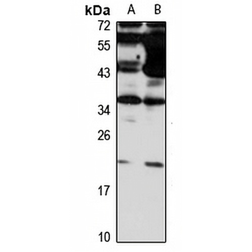 Claudin 14 Rabbit Polyclonal Antibody