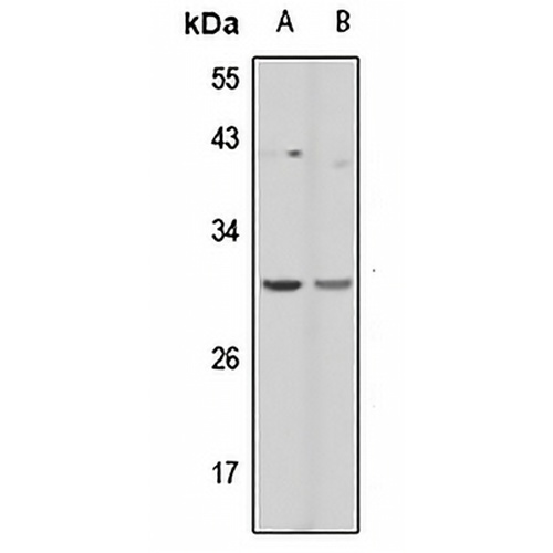 PCLN-1 Rabbit Polyclonal Antibody