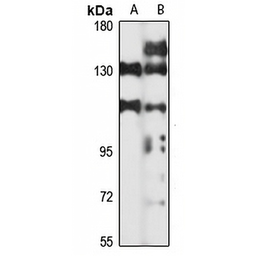 CLEC-16A Rabbit Polyclonal Antibody