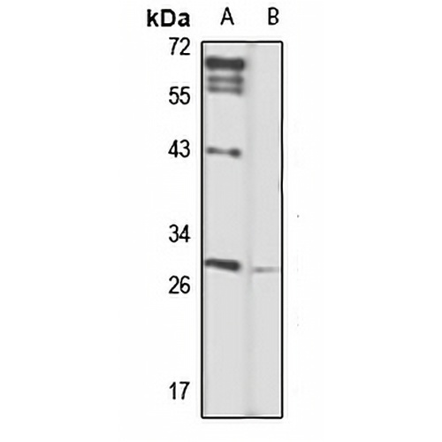 CLEC1B Rabbit Polyclonal Antibody