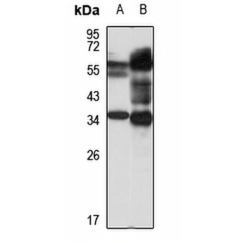 LLT1 Rabbit Polyclonal Antibody