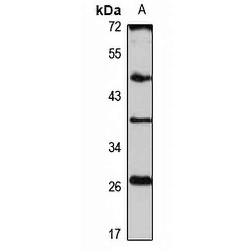 CLEC-6 Rabbit Polyclonal Antibody