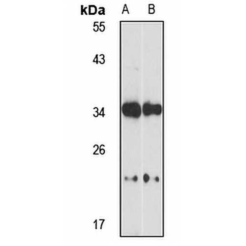 CLN8 Rabbit Polyclonal Antibody