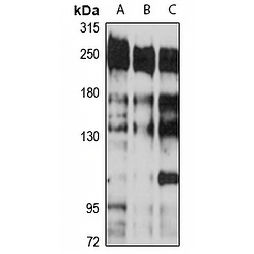 CNOT1 Rabbit Polyclonal Antibody
