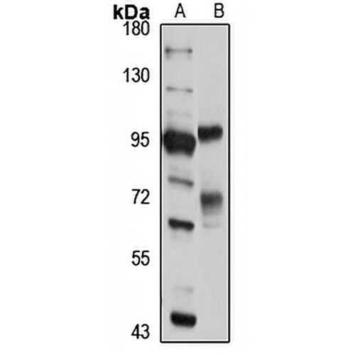 CNOT10 Rabbit Polyclonal Antibody