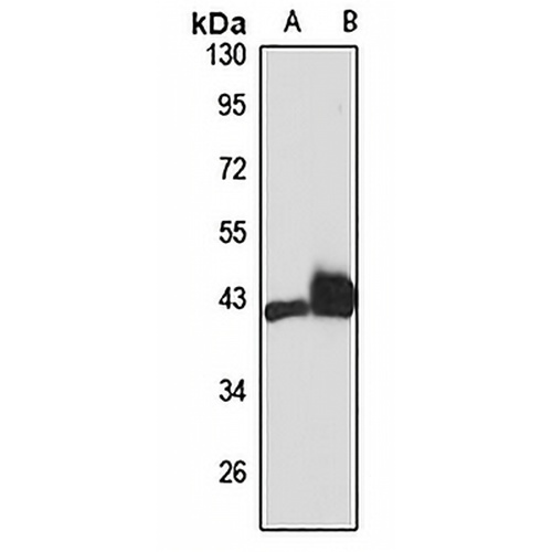 CB2 Rabbit Polyclonal Antibody