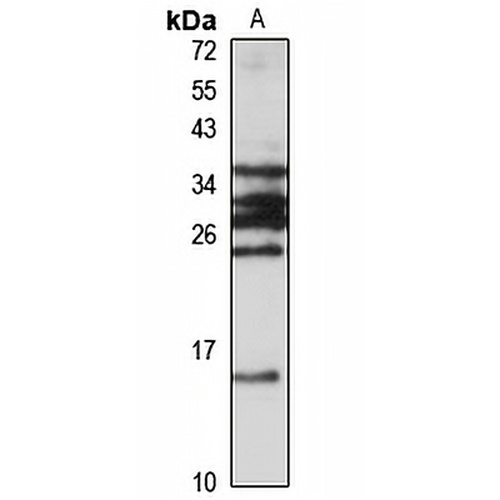 CCDC56 Rabbit Polyclonal Antibody