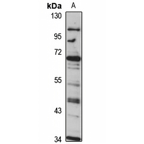 COG8 Rabbit Polyclonal Antibody