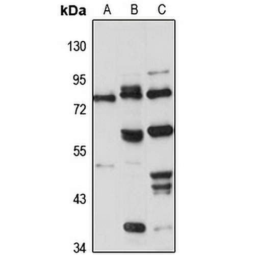 GPBP Rabbit Polyclonal Antibody