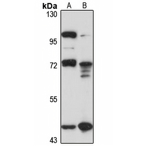 COLGALT2 Rabbit Polyclonal Antibody