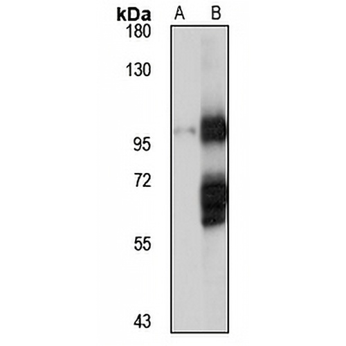 COPG2 Rabbit Polyclonal Antibody