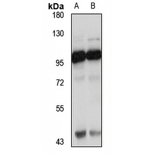 COPG2 Rabbit Polyclonal Antibody