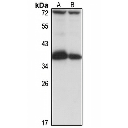 COQ9 Rabbit Polyclonal Antibody