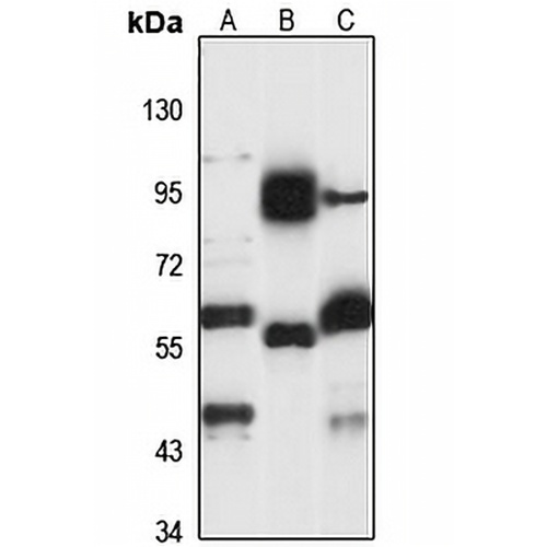 Coronin-2A Rabbit Polyclonal Antibody
