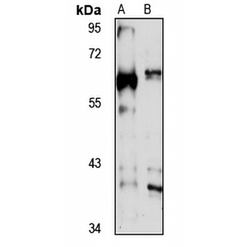 Coronin-2B Rabbit Polyclonal Antibody