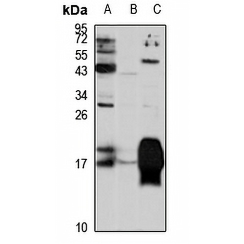 Complexin-1 Rabbit Polyclonal Antibody