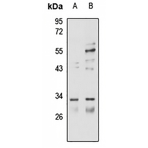 CPSF4 Rabbit Polyclonal Antibody