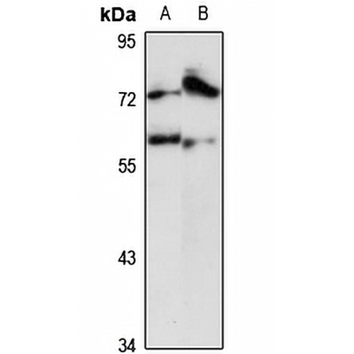 CPSF7 Rabbit Polyclonal Antibody
