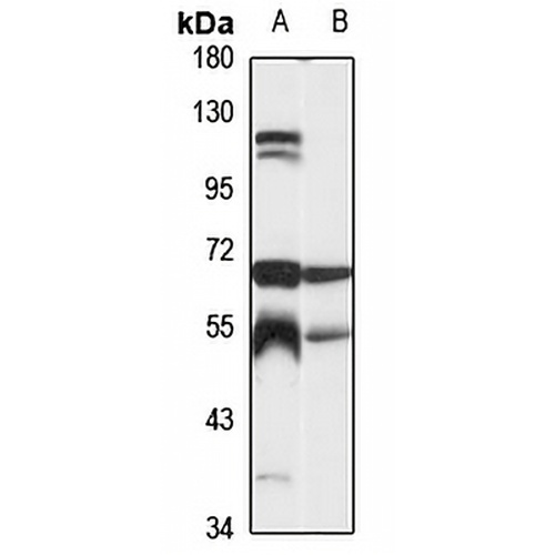 CPVL Rabbit Polyclonal Antibody