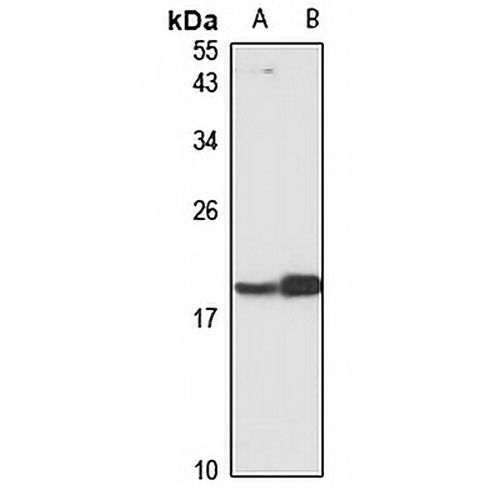 CRCP Rabbit Polyclonal Antibody
