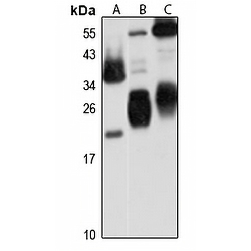 CRIP2 Rabbit Polyclonal Antibody