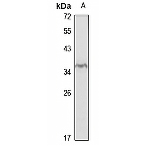Beta-B1 crystallin Rabbit Polyclonal Antibody