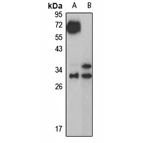 Gamma-D crystallin Rabbit Polyclonal Antibody
