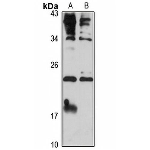 Placental Lactogen Rabbit Polyclonal Antibody