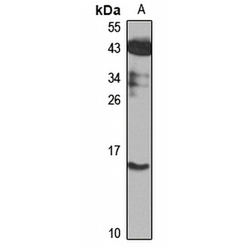 Cystatin S Rabbit Polyclonal Antibody