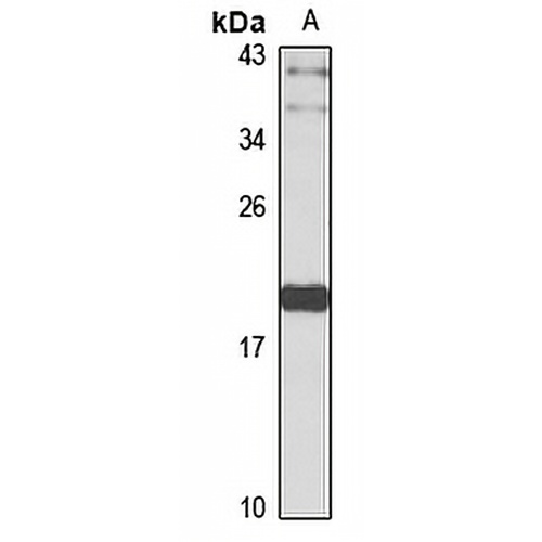 CTAG1B Rabbit Polyclonal Antibody