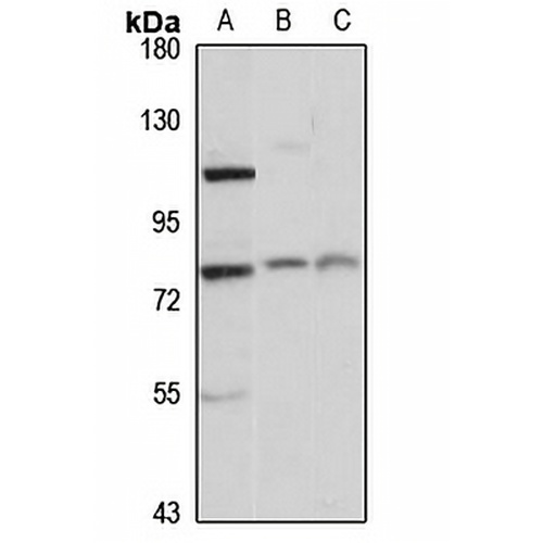 CTAGE1 Rabbit Polyclonal Antibody