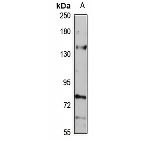 CTR9 Rabbit Polyclonal Antibody