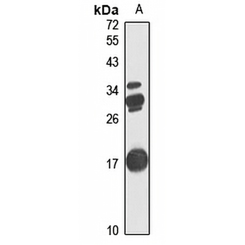 CUTA Rabbit Polyclonal Antibody