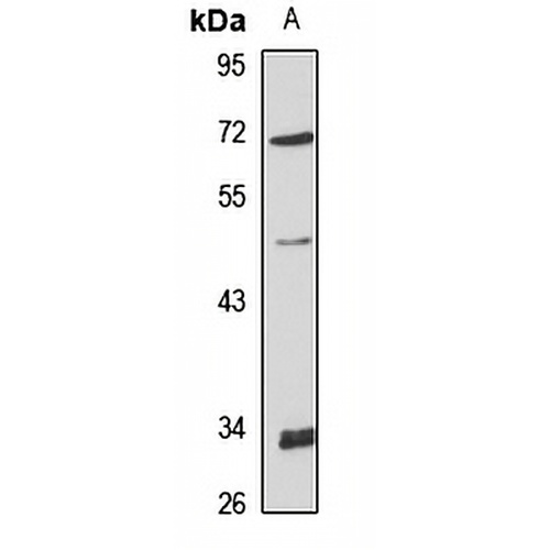 Cytochrome P450 19A1 Rabbit Polyclonal Antibody