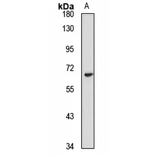 CYP27B1 Rabbit Polyclonal Antibody