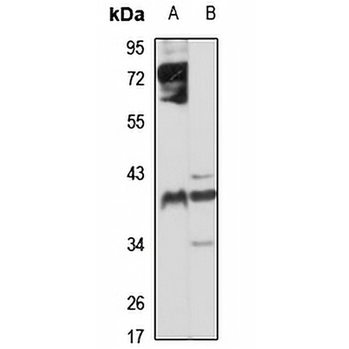 CYR61 Rabbit Polyclonal Antibody